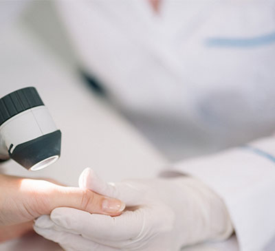 Global Radiodermatitis Treatment Market 2019-2023